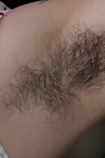 We Are Hairy Pics